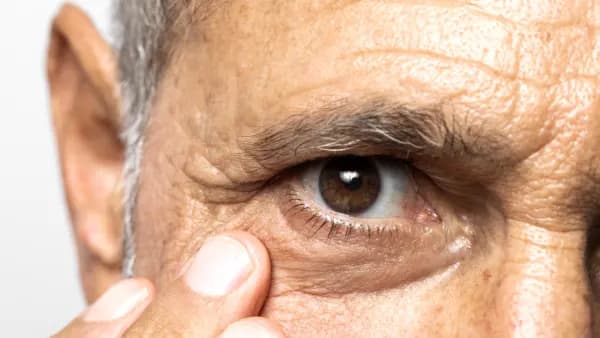 Desprendimiento de retina: reconocer las señales puede ayudar a proteger la visión